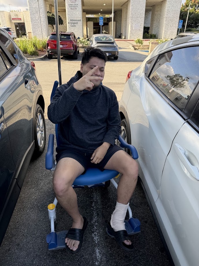 Sitting in a wheelchair in the car park outside urgent care with my ankle bandaged, one hand up at the camera